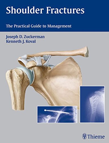 Shoulder Fractures The Practical Guide To Management 1st Edition Joseph David Zuckerman
