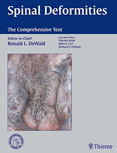 Spinal Deformities The Comprehensive Text 1st Edition Ronald L Scott