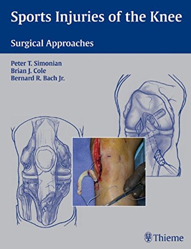 Sports Injuries Of The Knee Surgical Approaches Peter T Simonian