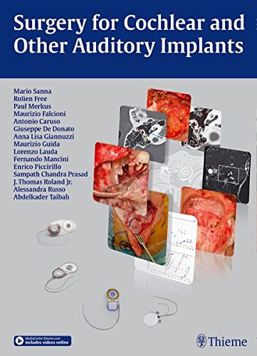 Surgery For Cochlear And Other Auditory Implants 1st Edition Mario Sanna