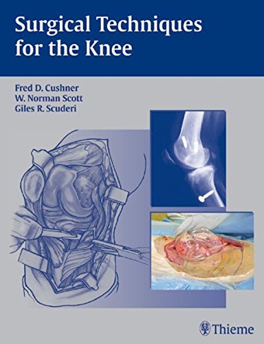 Surgical Techniques For The Knee 1st Edition Fred D Cushner