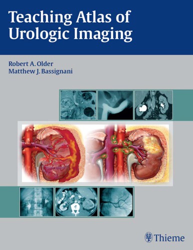Teaching Atlas Of Urologic Imaging 1st Edition Robert A Older