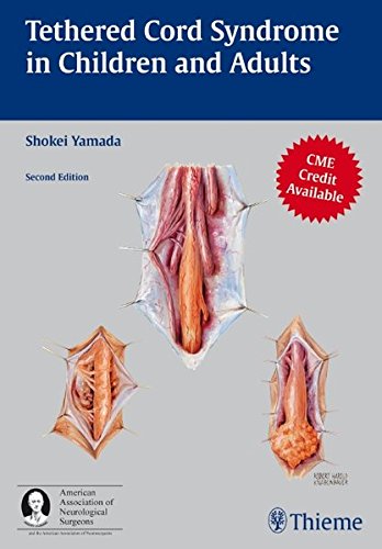 Tethered Cord Syndrome In Children And Adults 2nd Ed Shokei Yamada