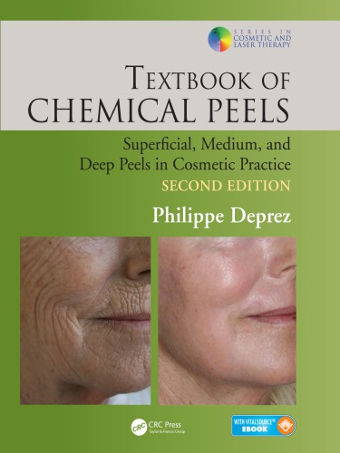 Textbook Of Chemical Peels Superficial Medium And Deep Peels In Cosmetic Practice Second Edition Philippe Deprez