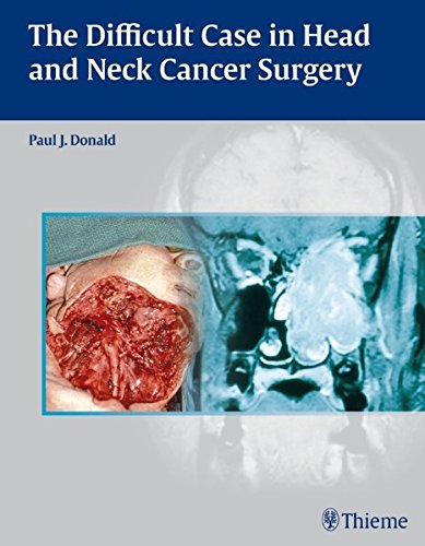 The Difficult Case In Head And Neck Cancer Surgery Rev Ed Paul J Donald