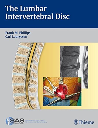 The Lumbar Intervertebral Disc 1st Edition Frank M Phillips