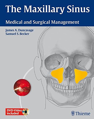 The Maxillary Sinus Medical And Surgical Management 1 Hardvd James A Duncavage
