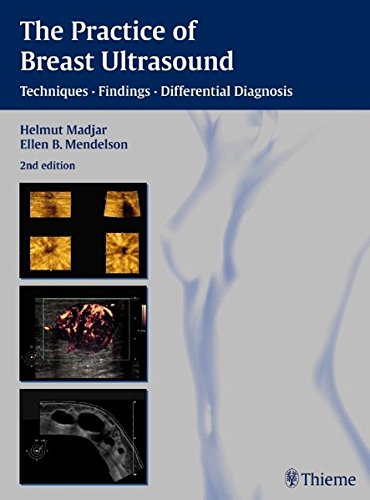 The Practice Of Breast Ultrasound Techniquesfindingsdifferential Diagnosis 2nd Ed Mendelson