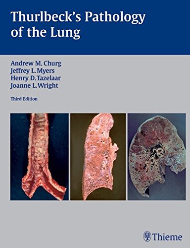 Thurlbecks Pathology Of The Lung 3rd Ed Andrew M Churg Jeffrey L Myers