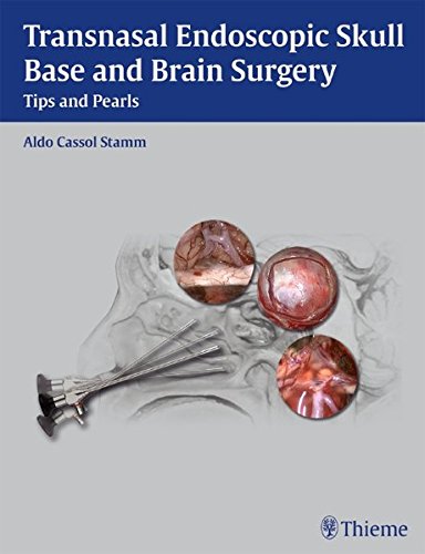 Transasal Endoscopic Skull Base And Brain Surgery Tips And Pearls 1st Edition Aldo Cassol Stamm