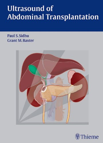 Ultrasound Of Abdominal Transplantation Paul S Sidhu Grant M Baxter