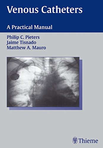 Venous Catheters A Practical Manual 1st Edition Philip C Pieters
