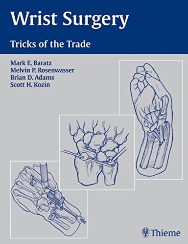 Wrist Surgery Tricks Of The Trade 1st Edition Mark E Baratz