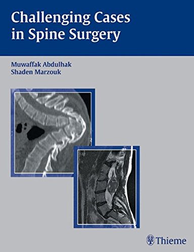 Challening Cases In Spine Surgery Muwaffak Abdulhak Shaden Marzouk
