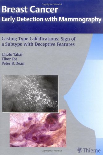 Casting Type Calcifications Sign Of A Subtype With Deceptive Features 1st Edition Laszlo Tabar