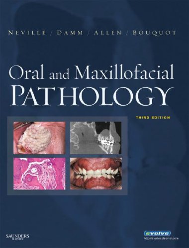 Oral And Maxillofacial Pathology 3rd Brad W Neville Douglas D Damm