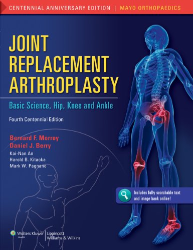 Joint Replacement Arthroplasty Basic Science Hip Knee And Ankle 4th Edition Bernard F Morrey