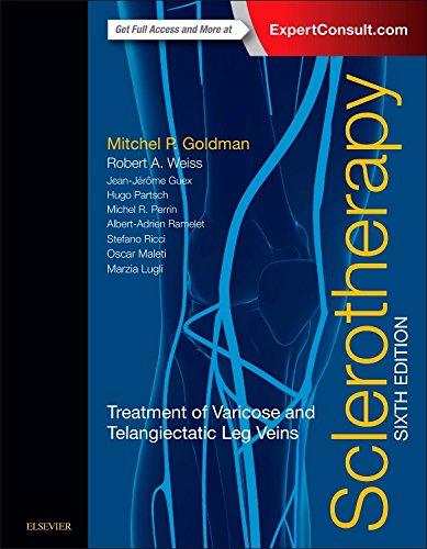 Sclerotherapy Treatment Of Varicose And Telangiectatic Leg Veins 6th Edition Mitchel P Goldman