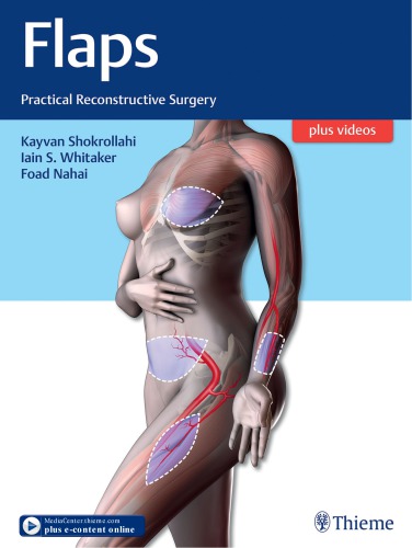 Flaps Practical Reconstructive Surgery Shokrollahi Kayvan Whitaker