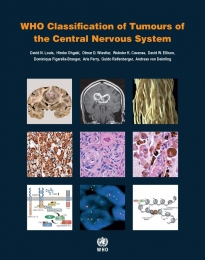 Who Classification Of Tumours Of The Central Nervous System 4th Edition Coll