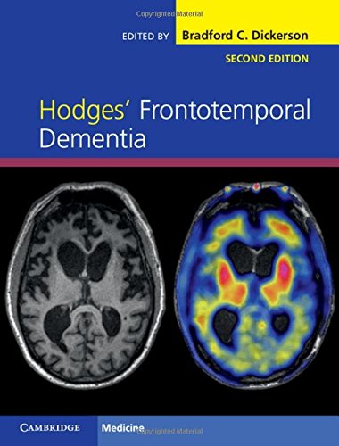 Hodges Frontotemporal Dementia 2nd Edition Bradford C Dickerson