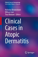 Clinical Cases In Atopic Dermatitis Nicholas Brownstone Wilson Liao