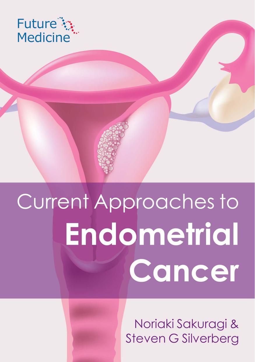 Current Approaches To Endometrial Cancer Sakuragi Noriakisilverberg