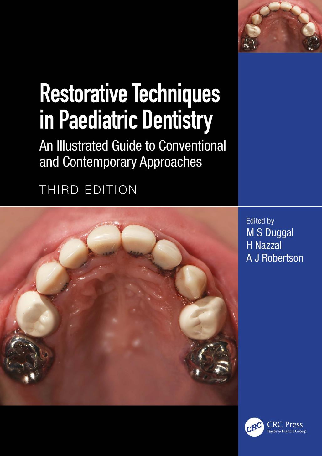 Restorative Techniques In Paediatric Dentistry An Illustrated Guide To Conventional And Contemporary Approaches Third Edition M S Duggal H Nazzal A J Robertson