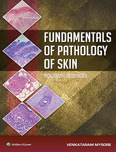 Fundamentals Of Pathology Of Skin 4e Venkataram Mysore