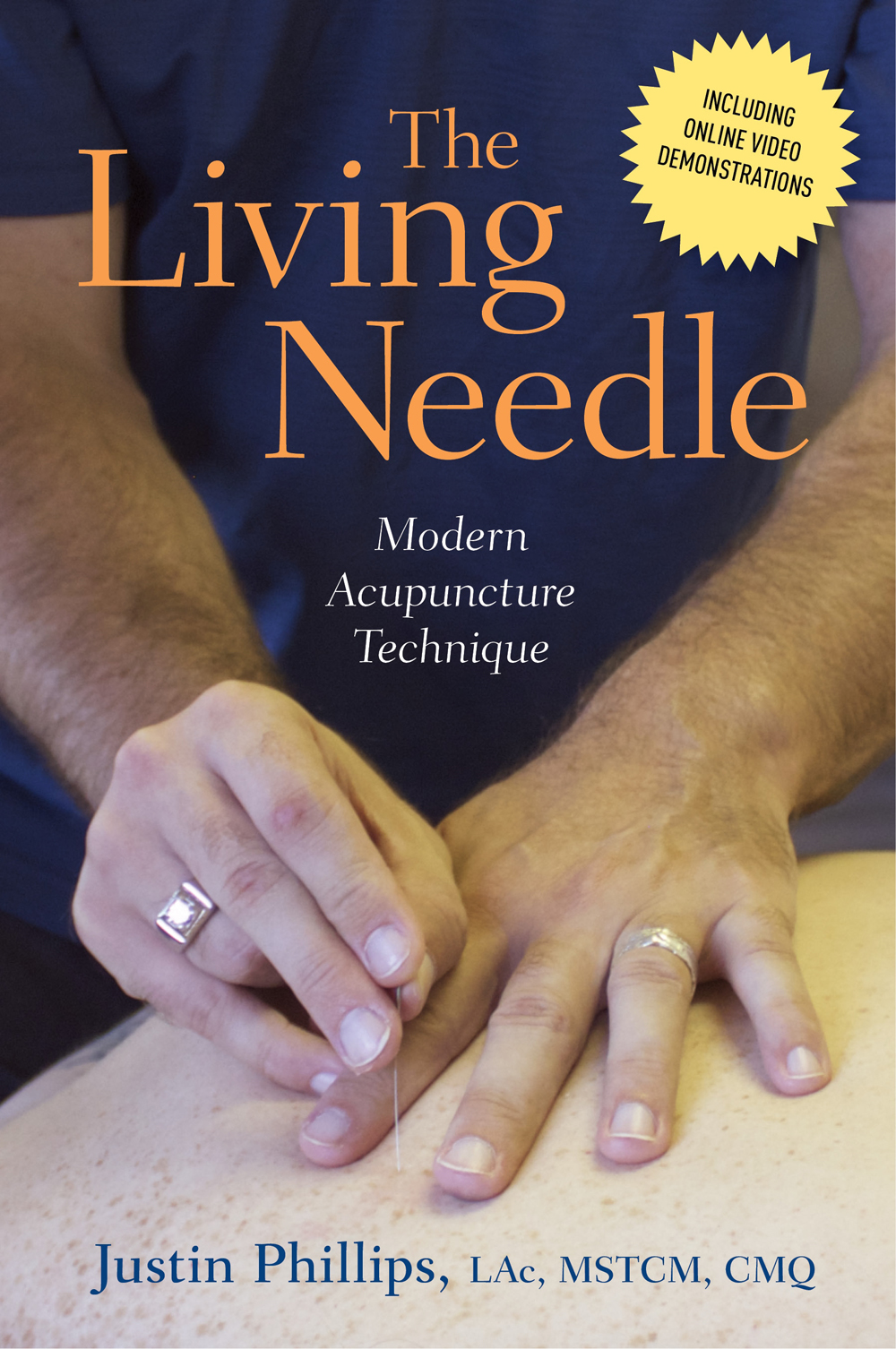The Living Needle Phillips Justin