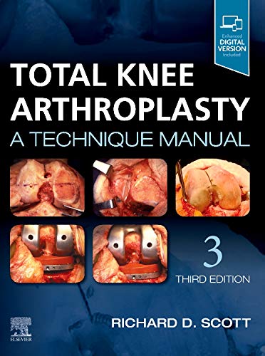 Total Knee Arthroplasty A Technique Manual 3rd Edition 3rd Scott Md