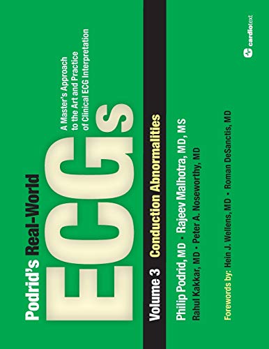 Podrids Realworld Ecgs Vol 3 Conduction Abnormalities 1st Edition Podrid