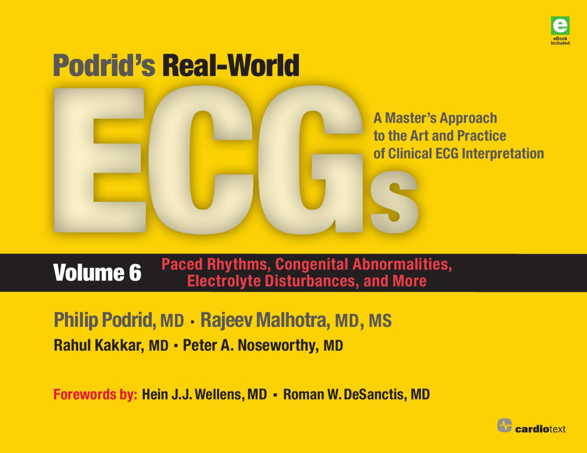 Podrids Realworld Ecgs Vol 6 Paced Rhythms Congenital Abnormalities Electrolyte Disturbances And More Podrid