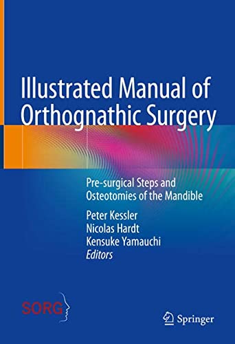 Illustrated Manual Of Orthognathic Surgery Presurgical Steps And Osteotomies Of The Mandible 1st Edition Peter Kessler