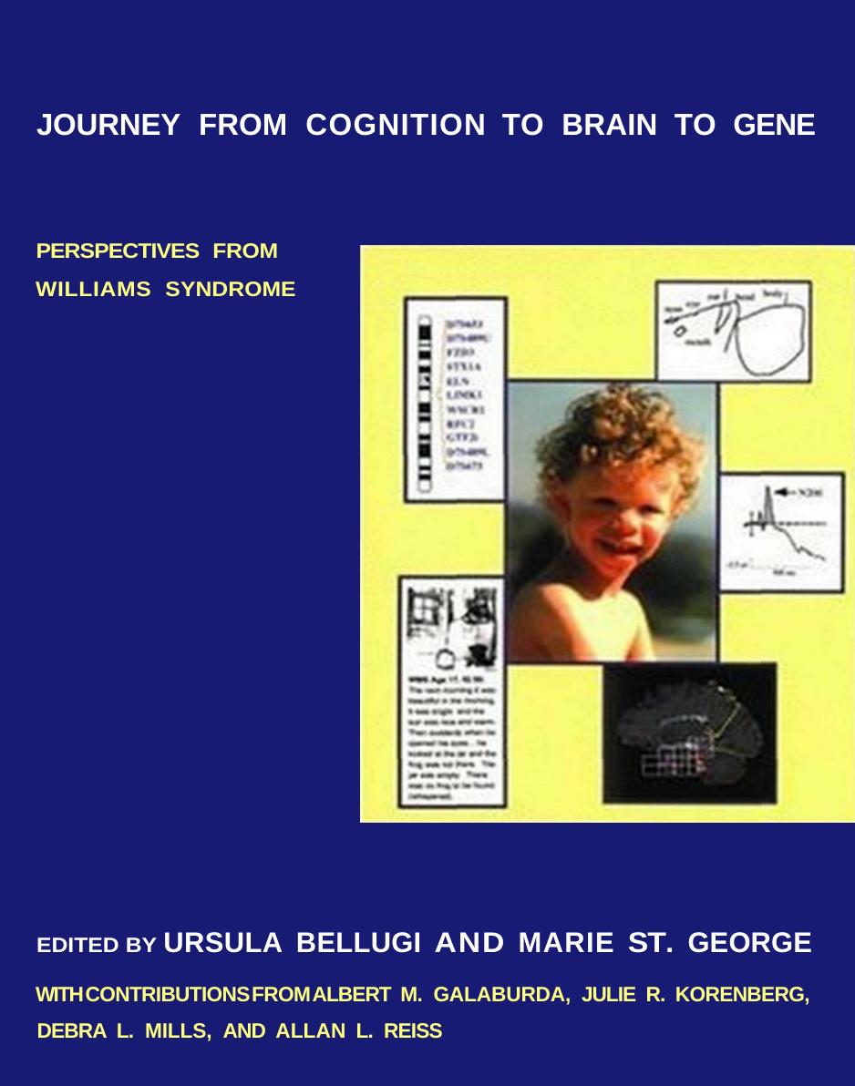 Journey From Cognition To Brain To Gene Perspectives From Williams Syndrome Ursula Bellugi
