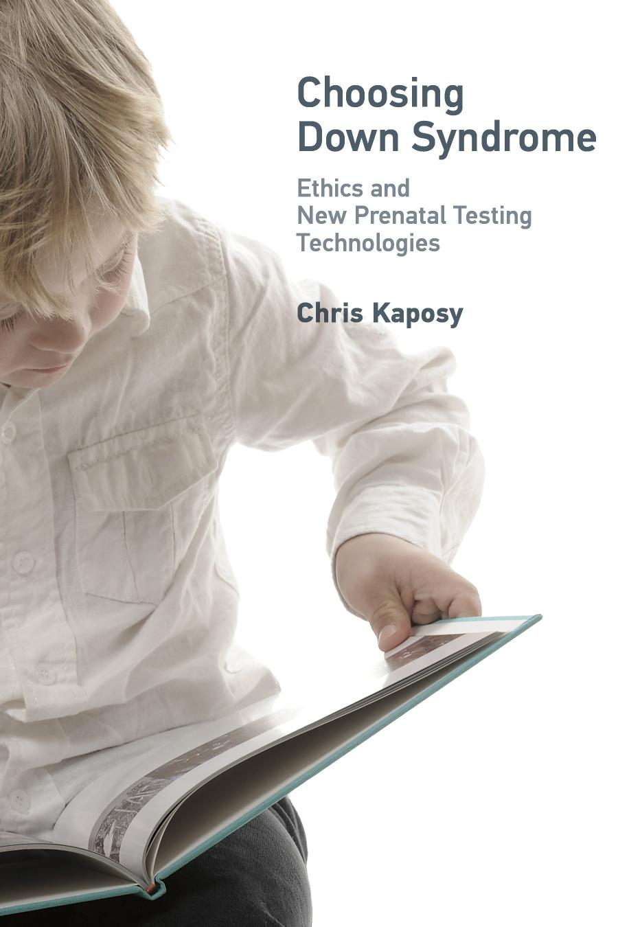 Choosing Down Syndrome Kaposy Chris