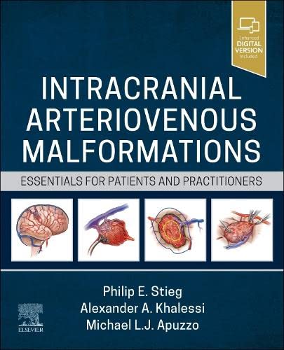 Intracranial Arteriovenous Malformations Essentials For Patients And Practitioners 1st Edition Philip E Stieg