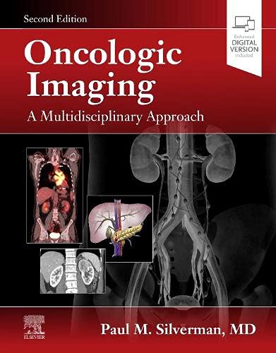 Oncologic Imaging A Multidisciplinary Approach 2nd Edition 2nd Paul Silverman