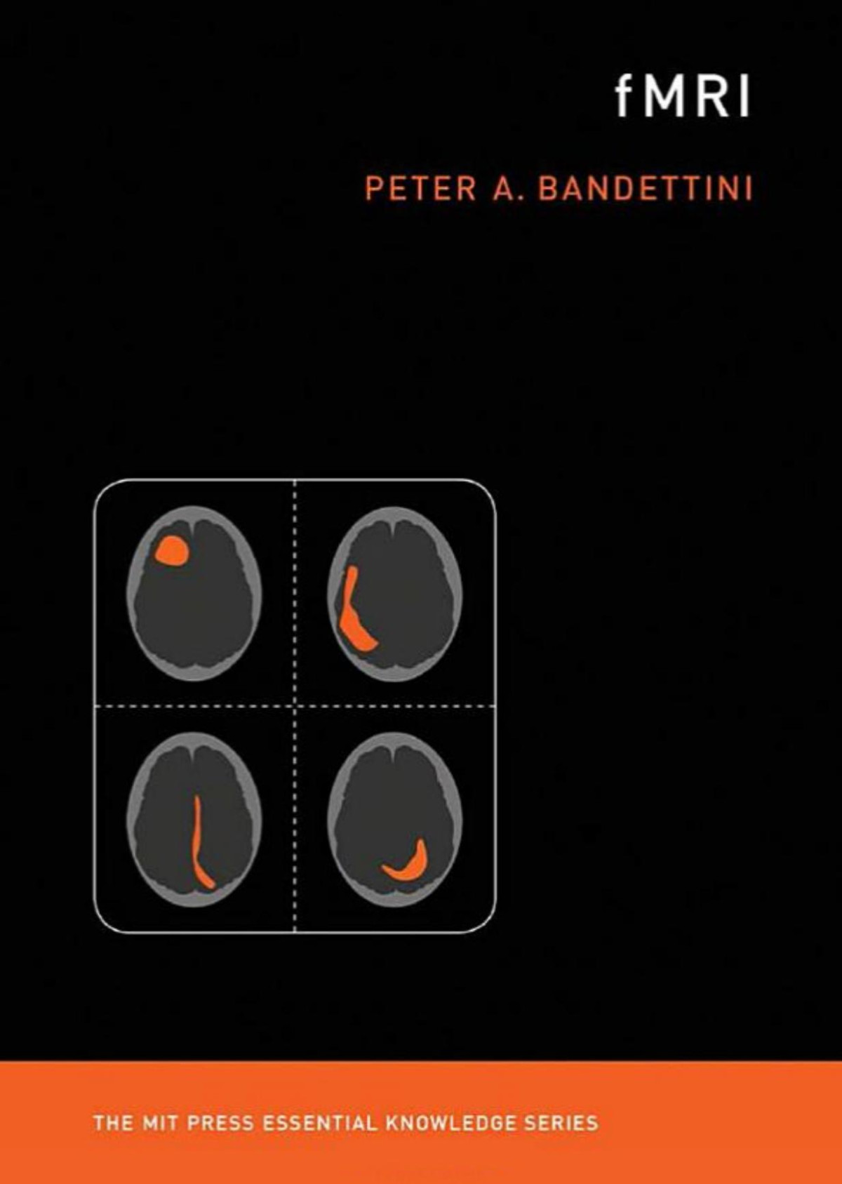 Fmri 1st Edition Peter A Bandettini