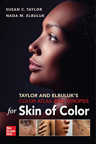Taylor And Elbuluks Color Atlas And Synopsis For Skin Of Color 1st Edition Susan C Taylor