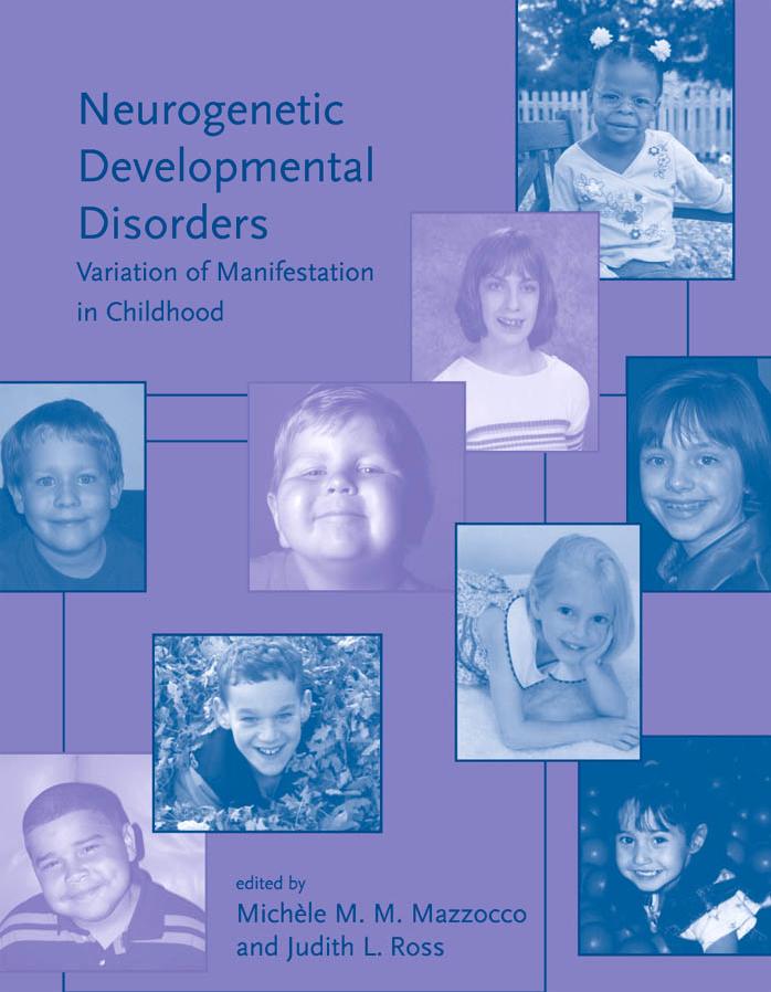 1650fm 116 Neurogenetic Developmental Disorders Variation Of Manifestation In Childhood