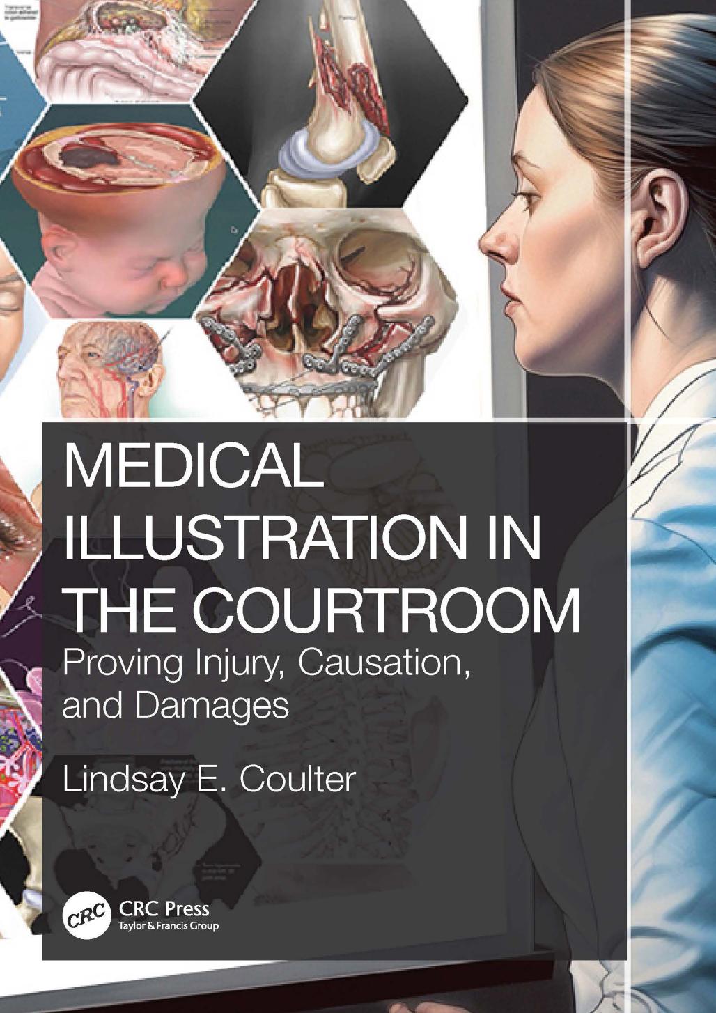 Medical Illustration In The Courtroom Proving Injury Causation And Damages Lindsay E Coulter