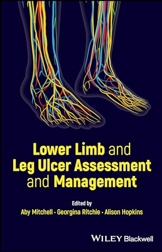 Lower Limb And Leg Ulcer Assessment And Management 1st Edition Aby Mitchell