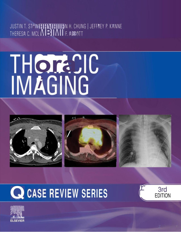 Thoracic Imaging Case Review Series 3e Jul 21 20231266289534elsevier Justin T Stowell Md Author