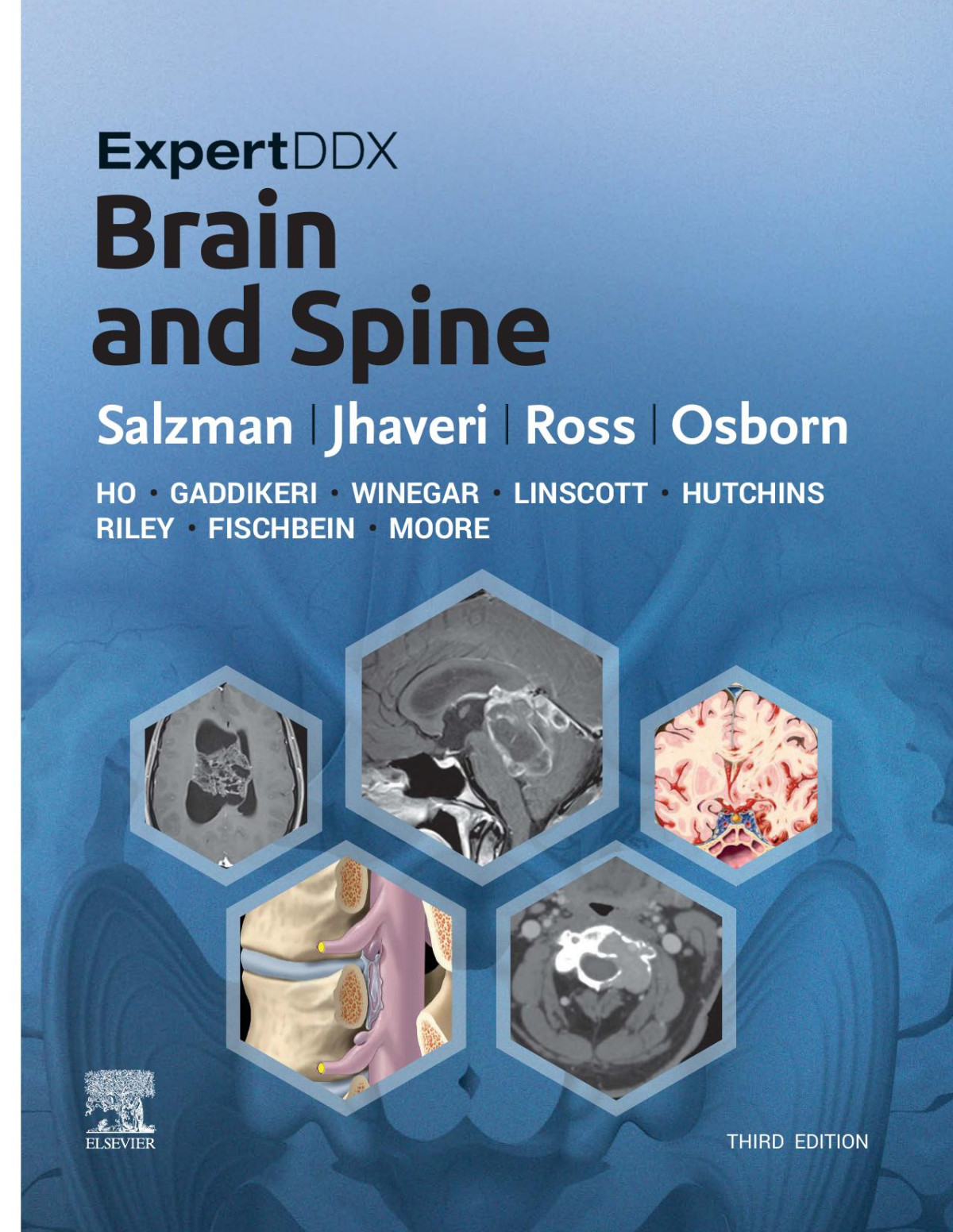 Expertddx Brain And Spine 3e 3rd Edition Salzman Karen L Jhaveri