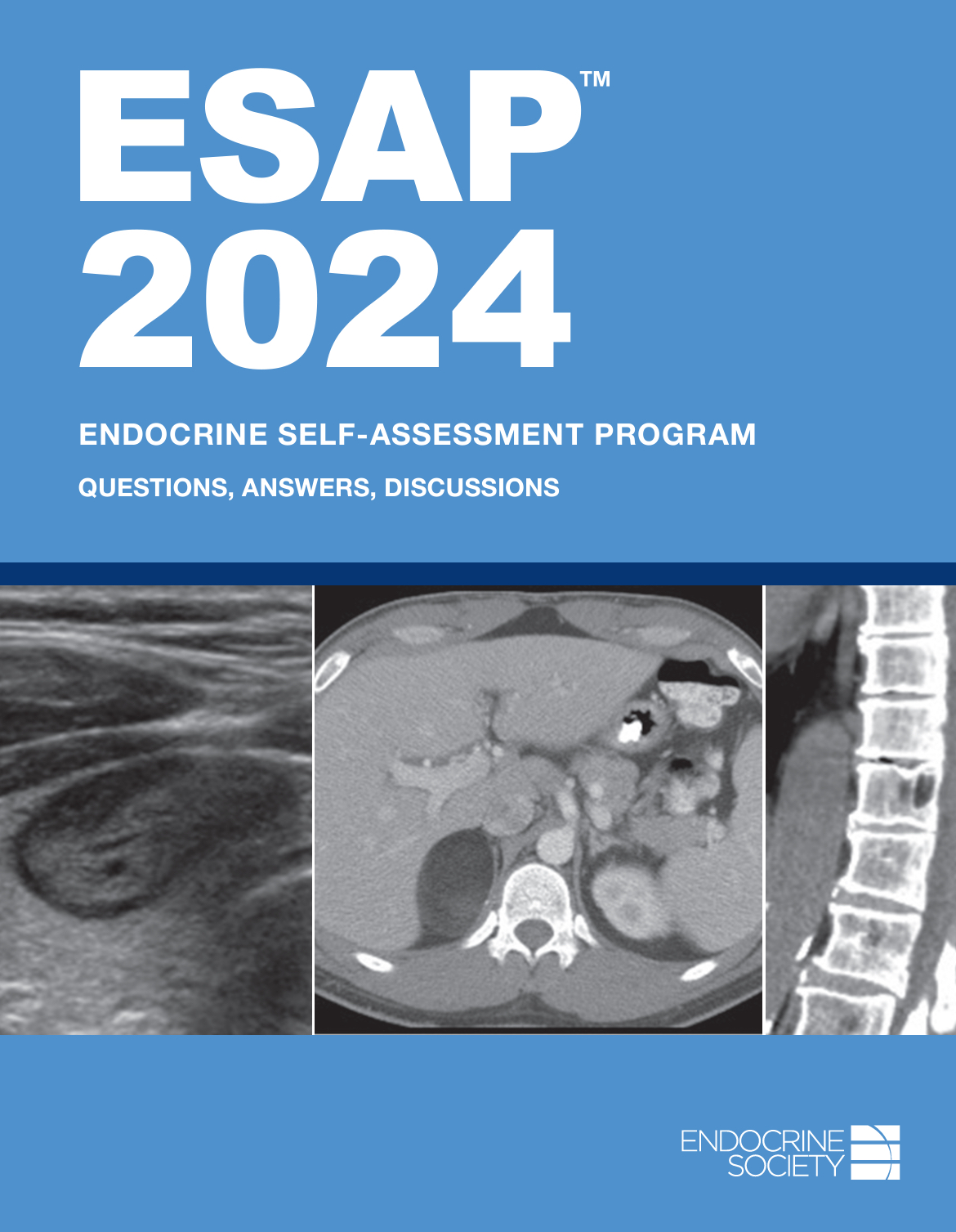 Esap 2024 Endocrine Selfassessment Program Endocrine Society