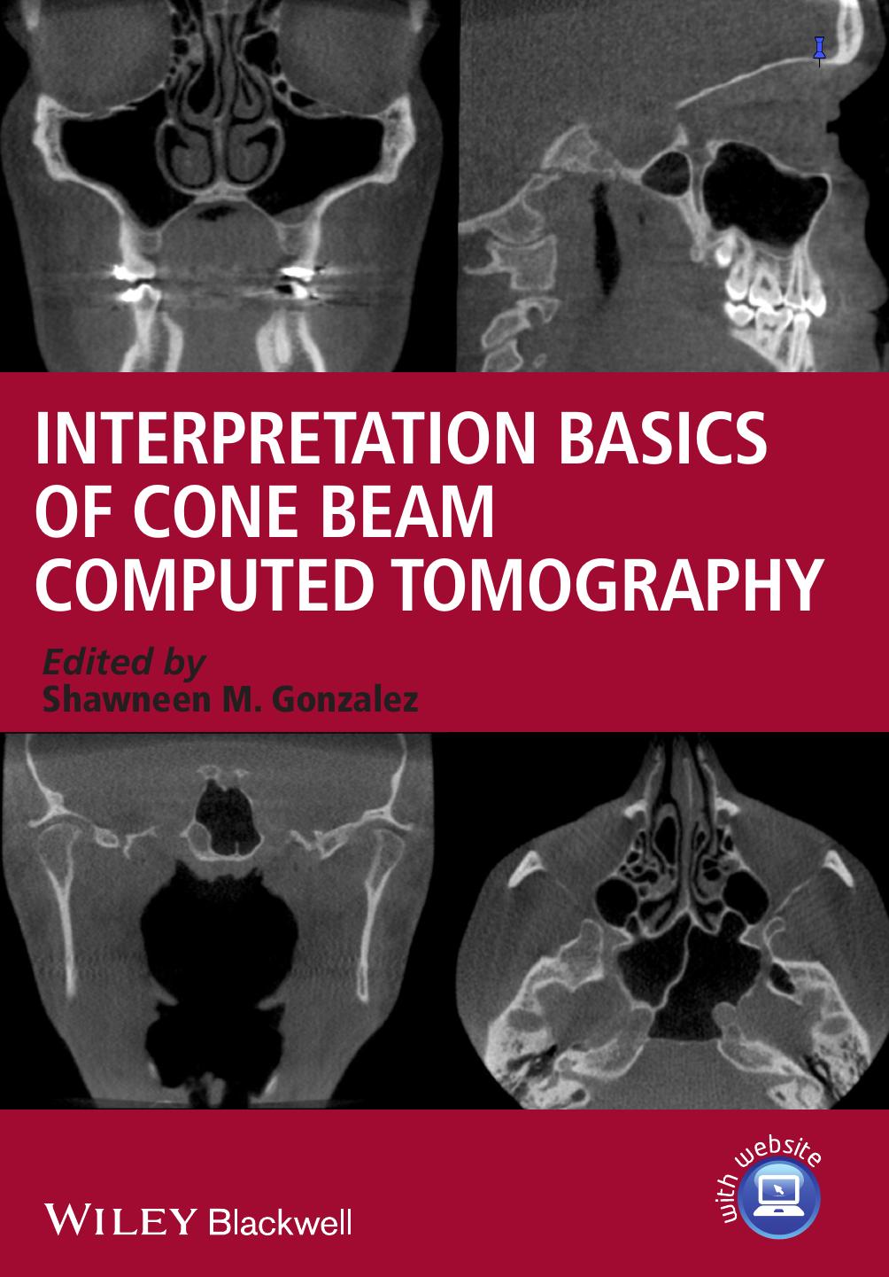 Interpretation Basics Of Cone Beam Computed Tomography Shawneen M Gonzalez