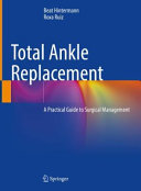 Total Ankle Replacement A Practical Guide To Surgical Management Beat Hintermann