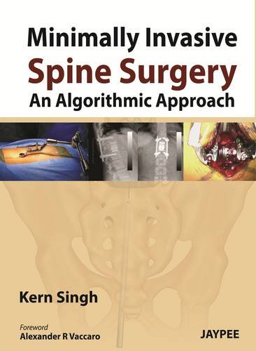 Minimally Invasive Spine Surgery An Algorithmic Approach Illustrated Singh