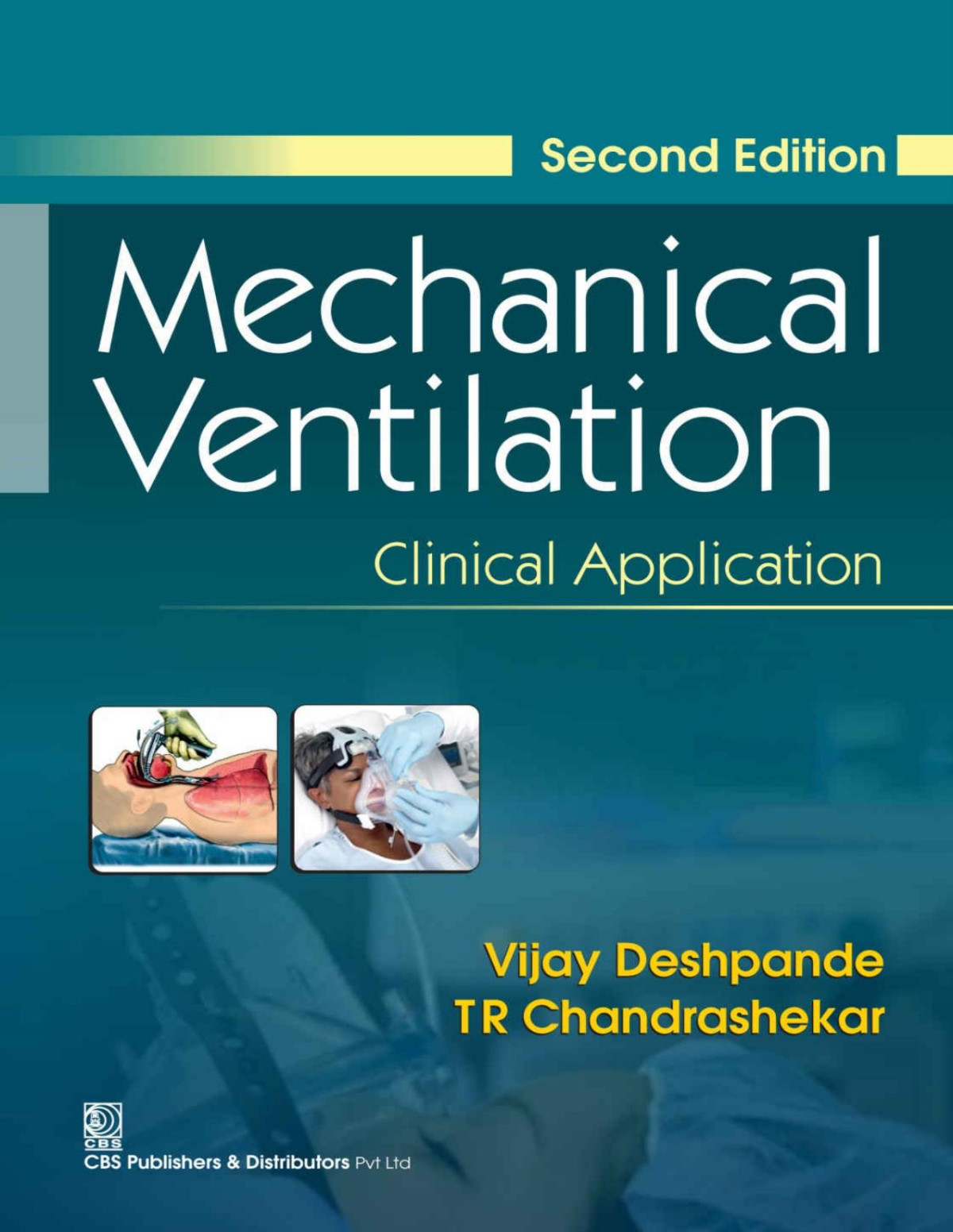 Mechanical Ventilation Vijay Deshpande Tr Chandrashekar